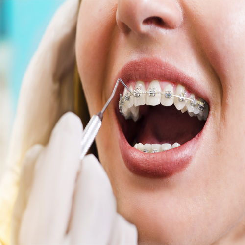 ORTHODONTIC  TREATMENT